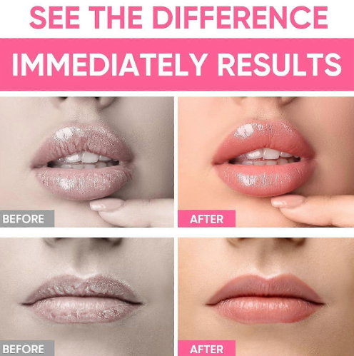 A310 Naktinė lūpų kaukė su kolagenu ir Hialurono Rūgštimi – Intensyvus Drėkinimas, 50 g